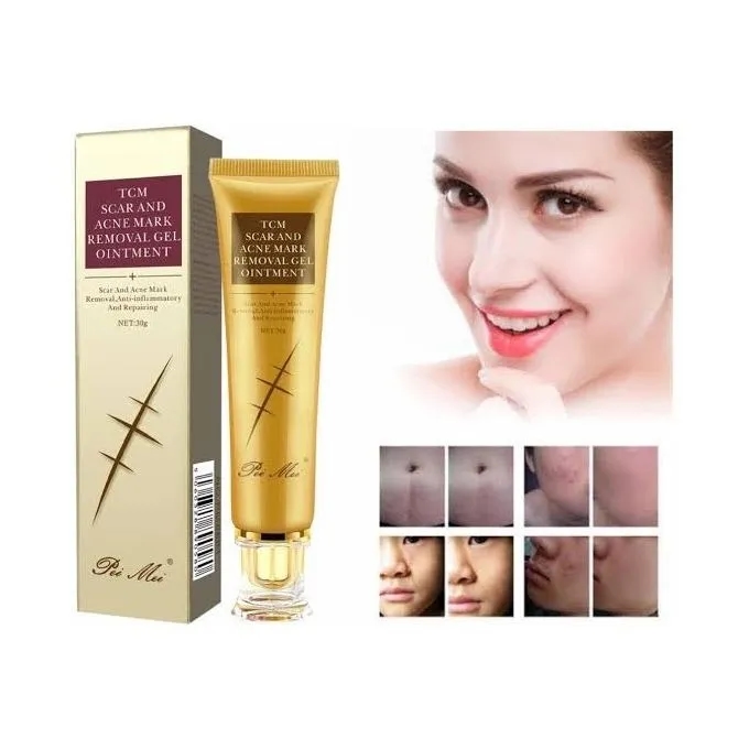 TCM Scar Removal Cream, Scar Reducing Treatment, Scar Remover Gel for Stretch Mark, Acne Scar, Spots, Surgical Scars, Burns, Cuts and C Section Scar 4