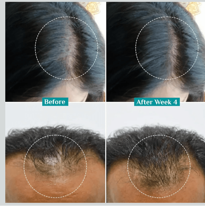 Pilgrim Advanced Hair Growth Serum 30ml 5