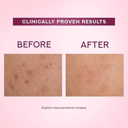 Pond's Bright Beauty Light Cream with UV Filter | Niasorcinol | 100x Better than Vitamin C | Niacinamide | Fades Dark Spots, Brightens Skin, 35g 3