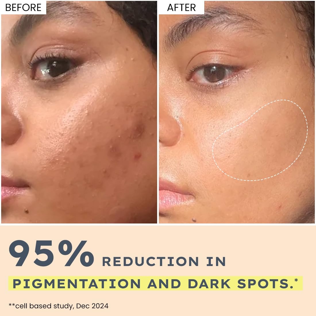 Hyphen 44% Rice Water Briightening Face Serum Pads | 5% Niacinamide & Alpha Arbutin to Reduces Dark Spots & Pigmentation | Toner Pads with Serum for Glowing Glass Skin | All Skin Types - 50 pcs 5
