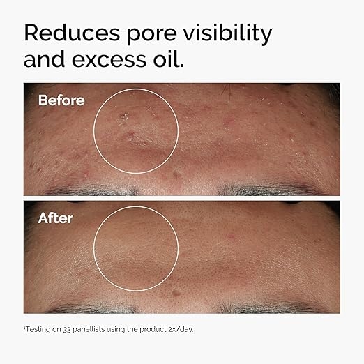 The Ordinary Niacinamide Serum 2