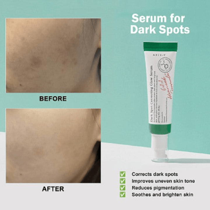 AXIS-Y Dark Spot Correcting Glow Serum 50ml / 1.69 fl. oz | Korean Skincare, Dark Spot Treatment, Hyperpigmentation Treatment ( Axis Y Serum ) 4
