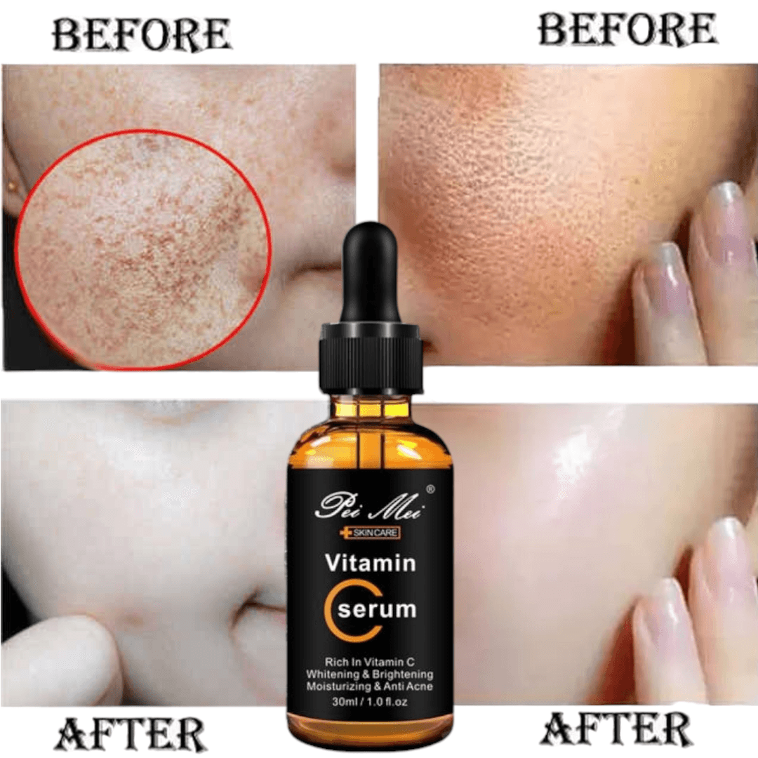 Pei Mei Hyaluronic Acid & Vitamin C Serum – 30ml | Brightening, Anti-Aging & Acne Care | Hydrating Face Serum for Glowing Skin / By Elysian Glow 1