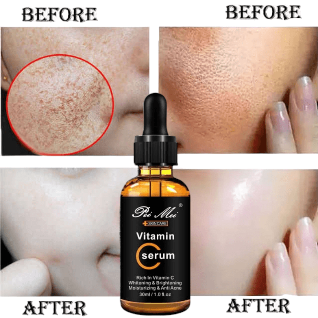 Pei Mei Hyaluronic Acid & Vitamin C Serum – 30ml | Brightening, Anti-Aging & Acne Care | Hydrating Face Serum for Glowing Skin / By Elysian Glow 1