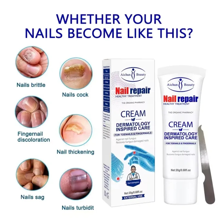 Nail Repair Cream For Toenails & Fingernails Repairs Nail Fungus And Damaged Nails 20g 2