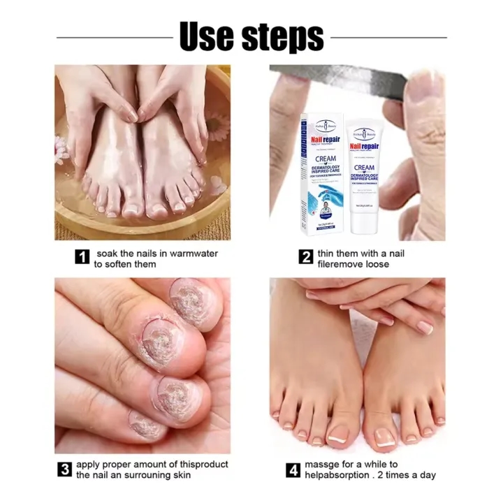 Nail Repair Cream For Toenails & Fingernails Repairs Nail Fungus And Damaged Nails 20g 3