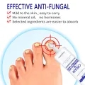 Nail Repair Cream For Toenails & Fingernails Repairs Nail Fungus And Damaged Nails 20g 5