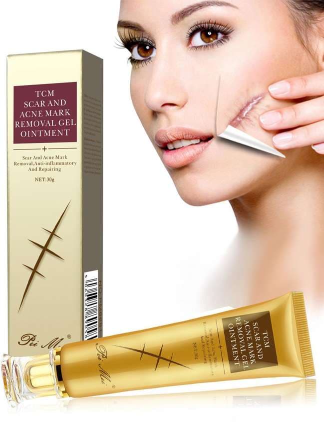 TCM Scar Removal Cream, Scar Reducing Treatment, Scar Remover Gel for Stretch Mark, Acne Scar, Spots, Surgical Scars, Burns, Cuts and C Section Scar 1
