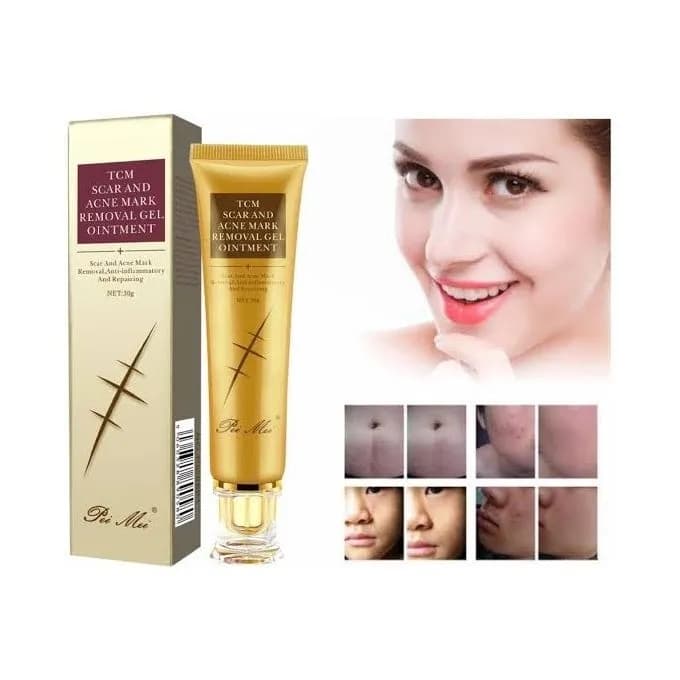 TCM Scar Removal Cream, Scar Reducing Treatment, Scar Remover Gel for Stretch Mark, Acne Scar, Spots, Surgical Scars, Burns, Cuts and C Section Scar 3