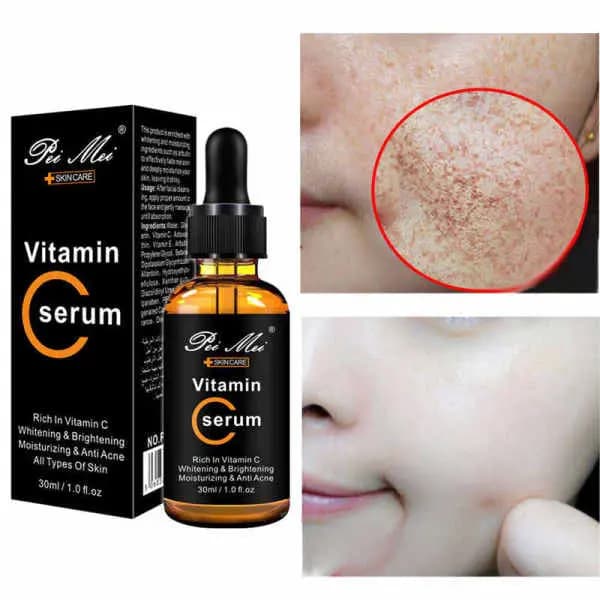  Hyaluronic Acid Anti-Aging Serum For Wrinkles And Acne-30ml 1