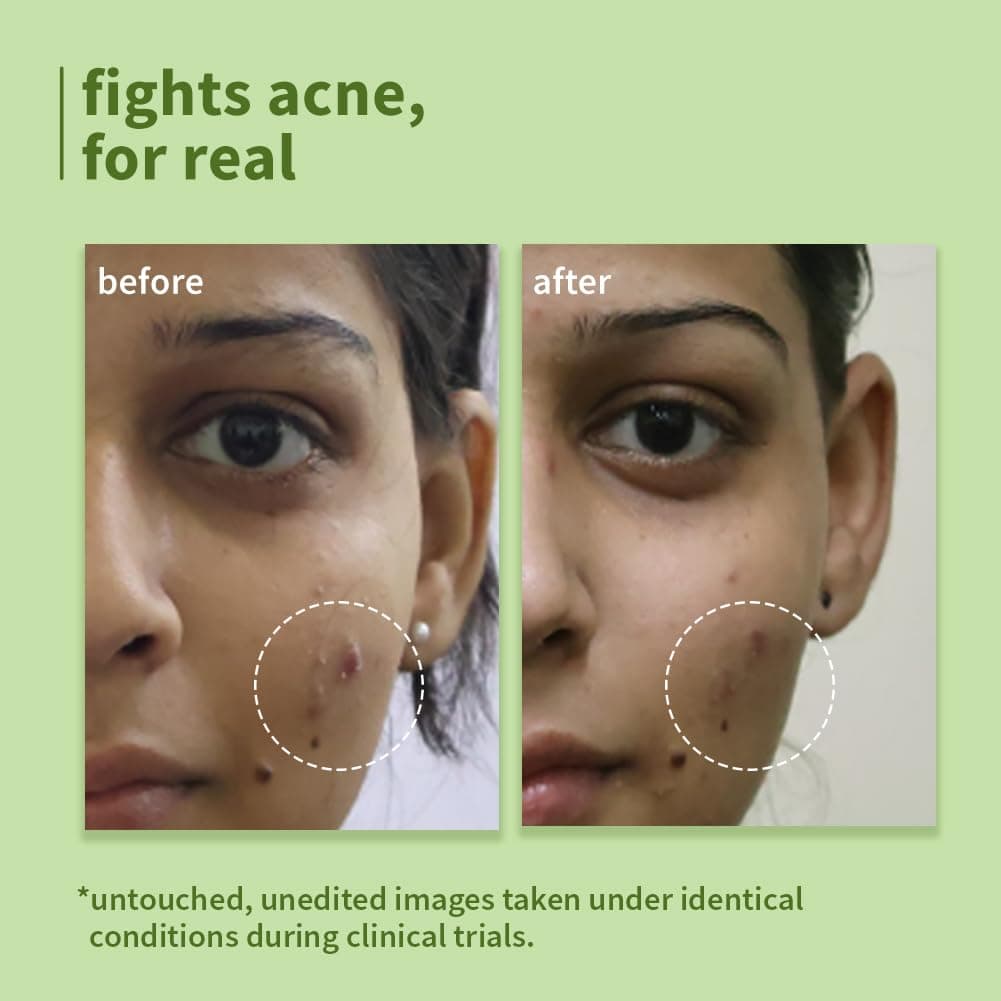 Plum Green Tea Pore Cleansing Face Wash | Acne Face Wash | Oily Skin | Face Wash for Women & Men | 100ml 3