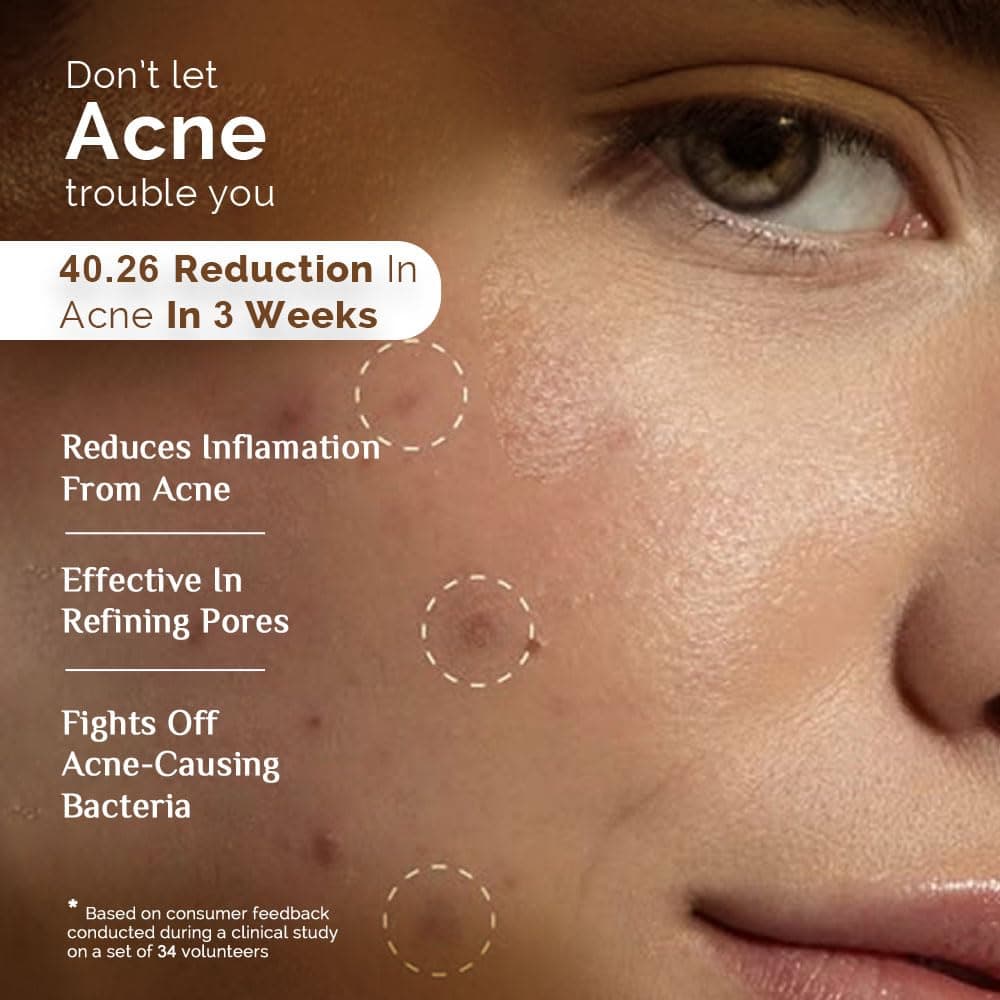 Richfeel Calendula Anti Acne Soap  3