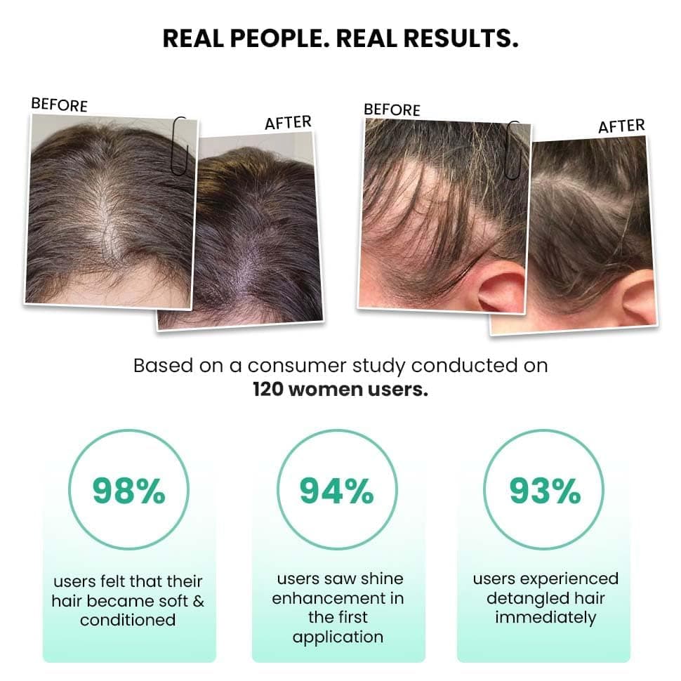 ThriveCo Rosemary Water Hair Spray | With 100% Natural Rosemary Extract, Rice Water & Hyaluronic Acid | For Hair Growth, Hair Fall Control, Hair Conditioning & Hair Shine | Men & Women,  4