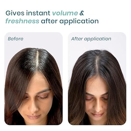 WishCare Air Powder Dry Shampoo for Oily Hair & Scalp - 10gm 2