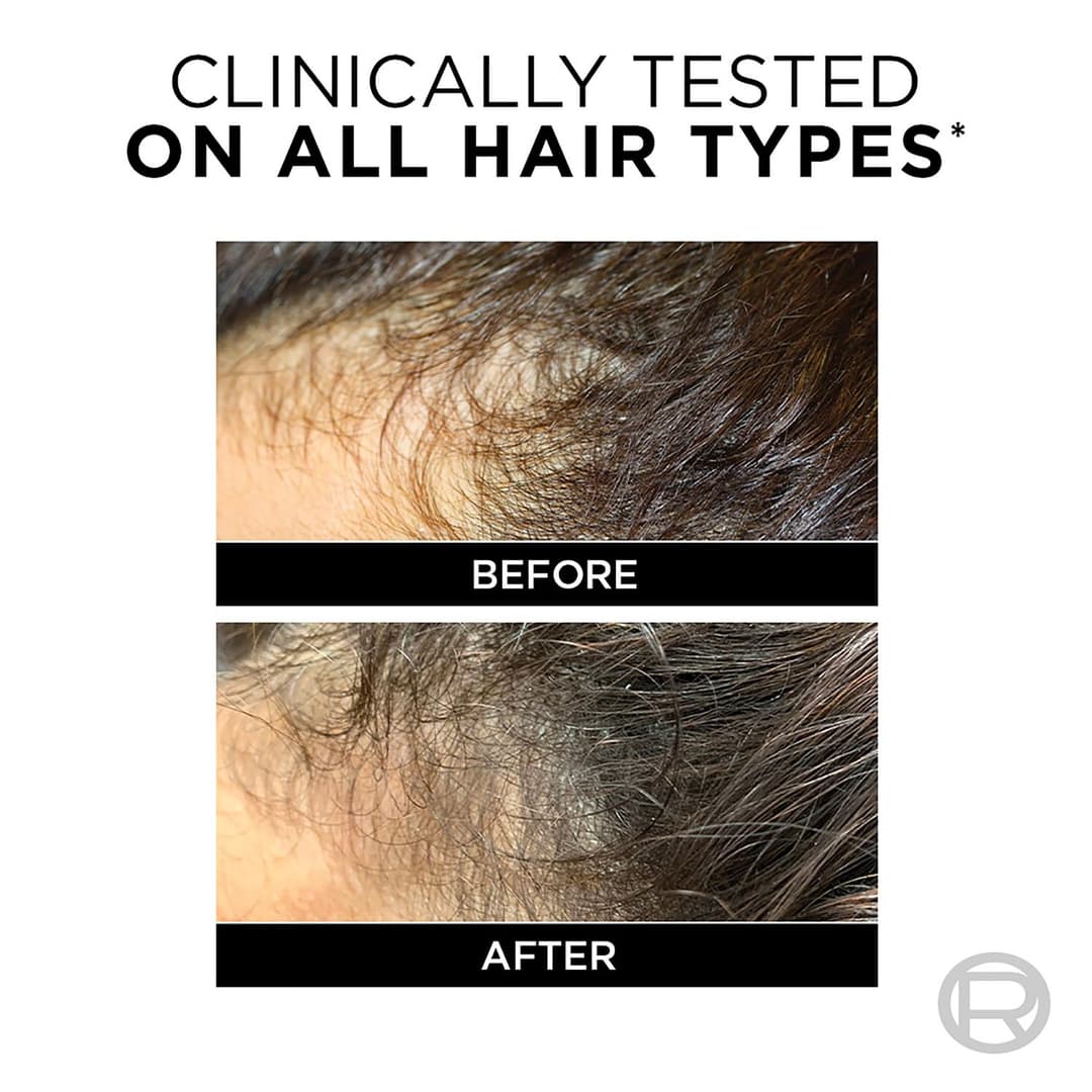 Loreal Paris Fall Resist 3X Anti Hair Fall Shampoo  4