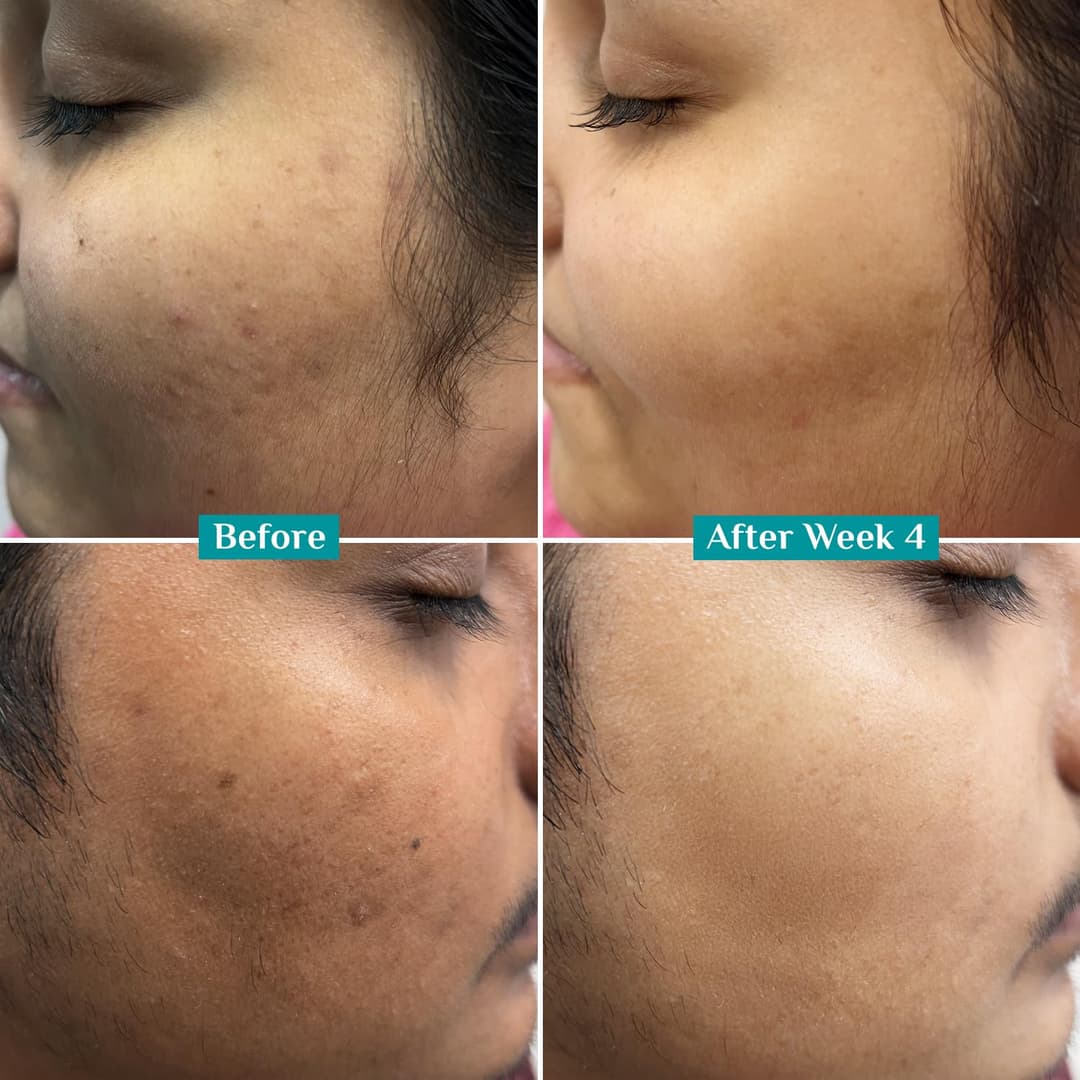 Pilgrim 10% Vitamin C Face Serum For Daily Brightness 10 ml | Face serum for glowing skin | Reduces Dark Spots & Evens Skin Tone | For Oily, Combination, Normal Skin Types | Fragrance Free | For Men and Women 3