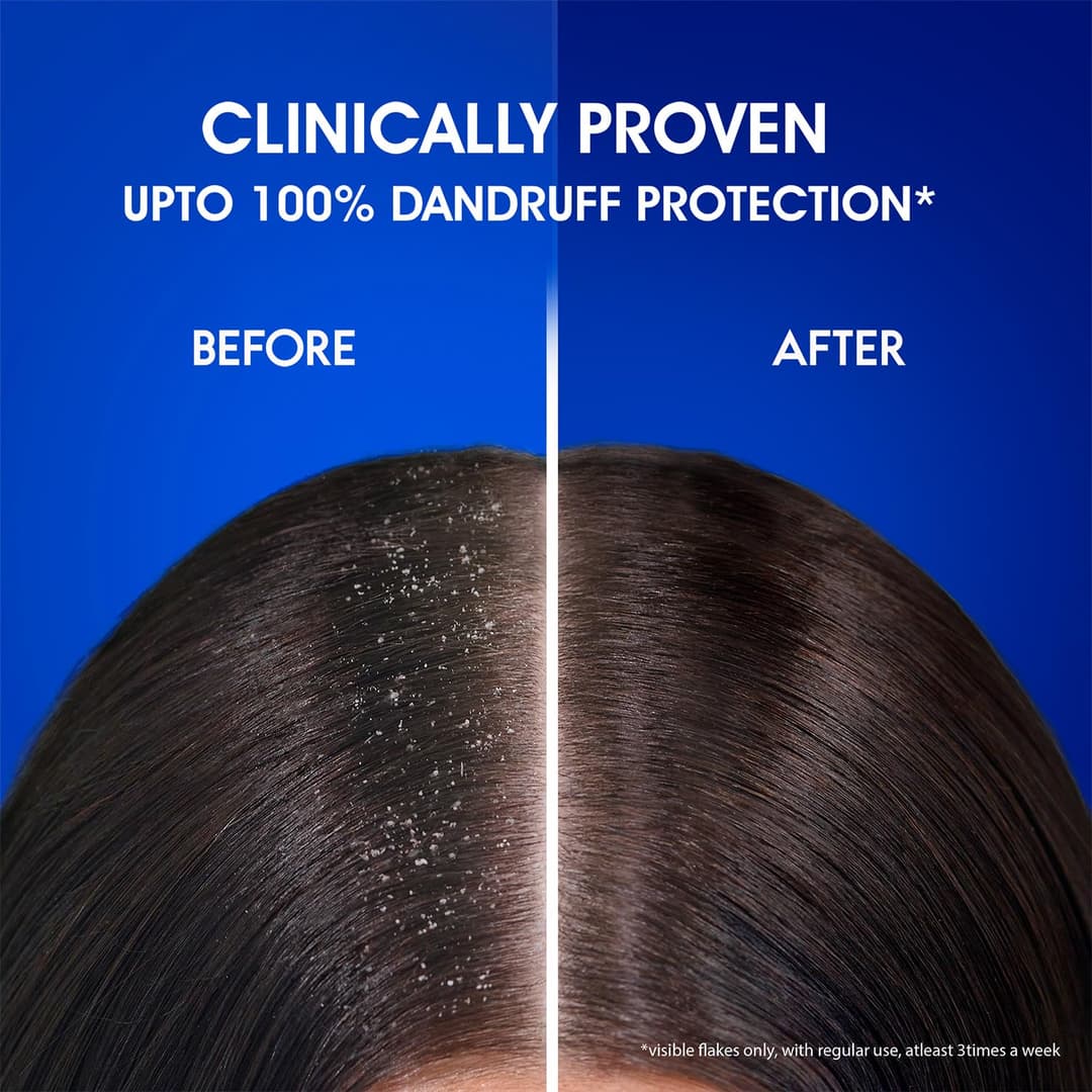  Hairfall Anti Dandruff Shampoo  6