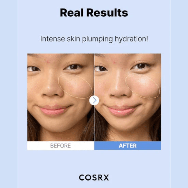 Cosrx Hyaluronic Acid Hydra Power Essence 100 ml | Korean Skincare 2