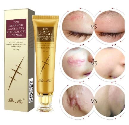 TCM SCAR AND ACNE MARK REMOVAL GEL OINTMENT 30 G,  5