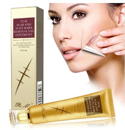 TCM SCAR AND ACNE MARK REMOVAL GEL OINTMENT 30 G,  2