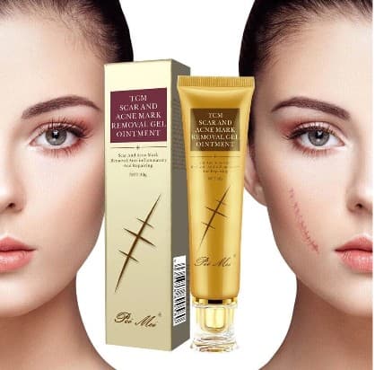 TCM SCAR AND ACNE MARK REMOVAL GEL OINTMENT 30 G,  1