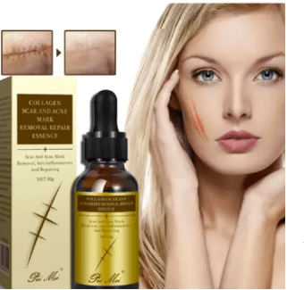 Scar Removal Cream - TCM Scar Serum for Surgical Scars, Acne Skin Care Cream, Acne Treatment Cream for Scars, Burns, Stretch Marks, Acne Spots 30Gm 2