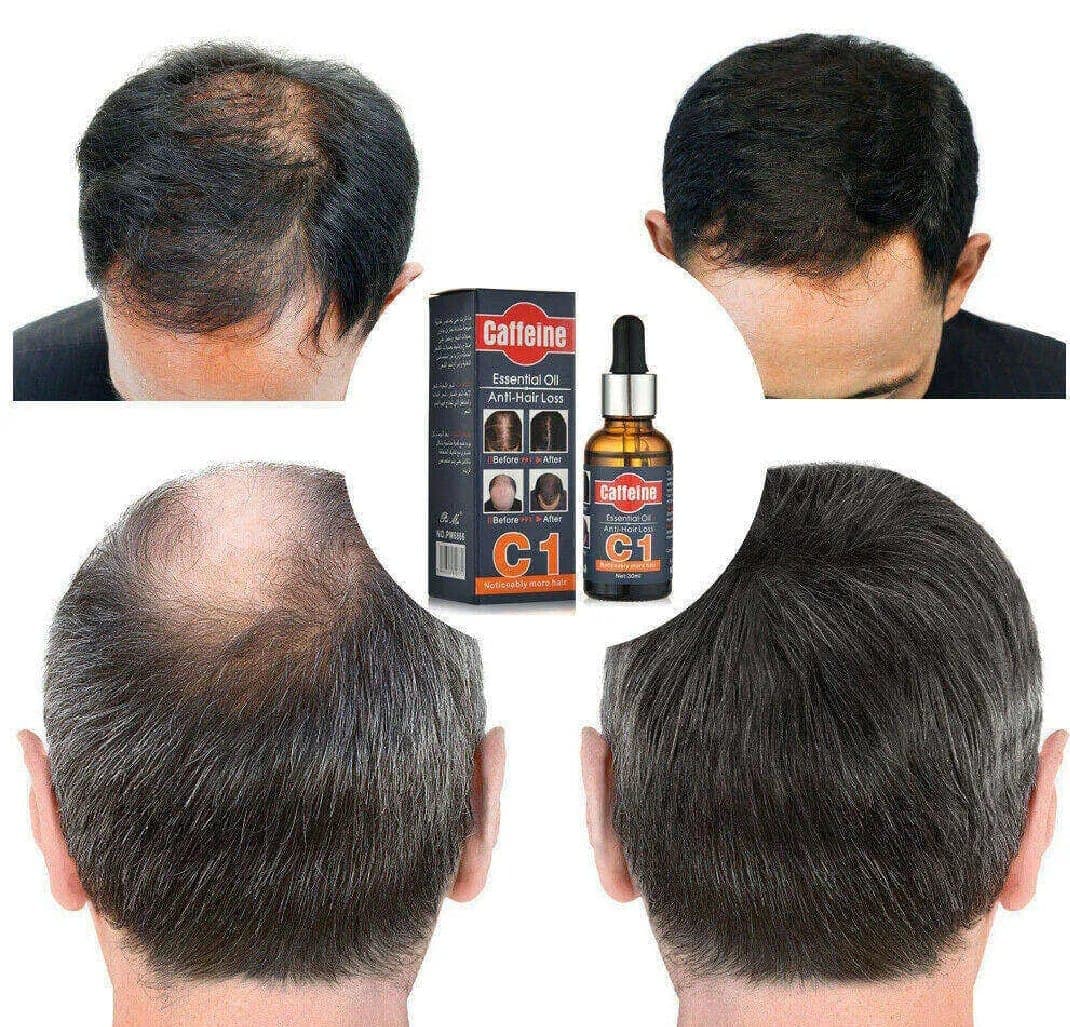Pei Mei Anti Hair Loss Caffeine Essential Oil - 30ml