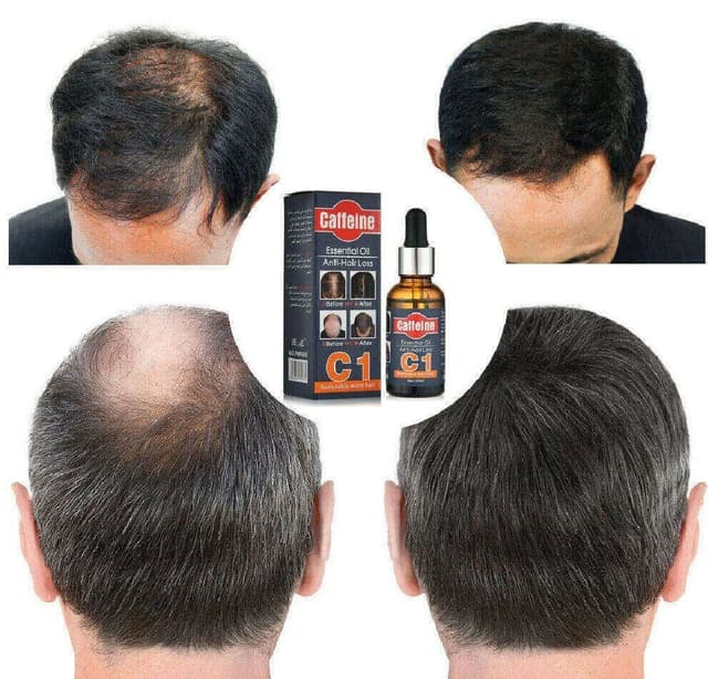 Pei Mei Anti Hair Loss Caffeine Essential Oil - 30ml
