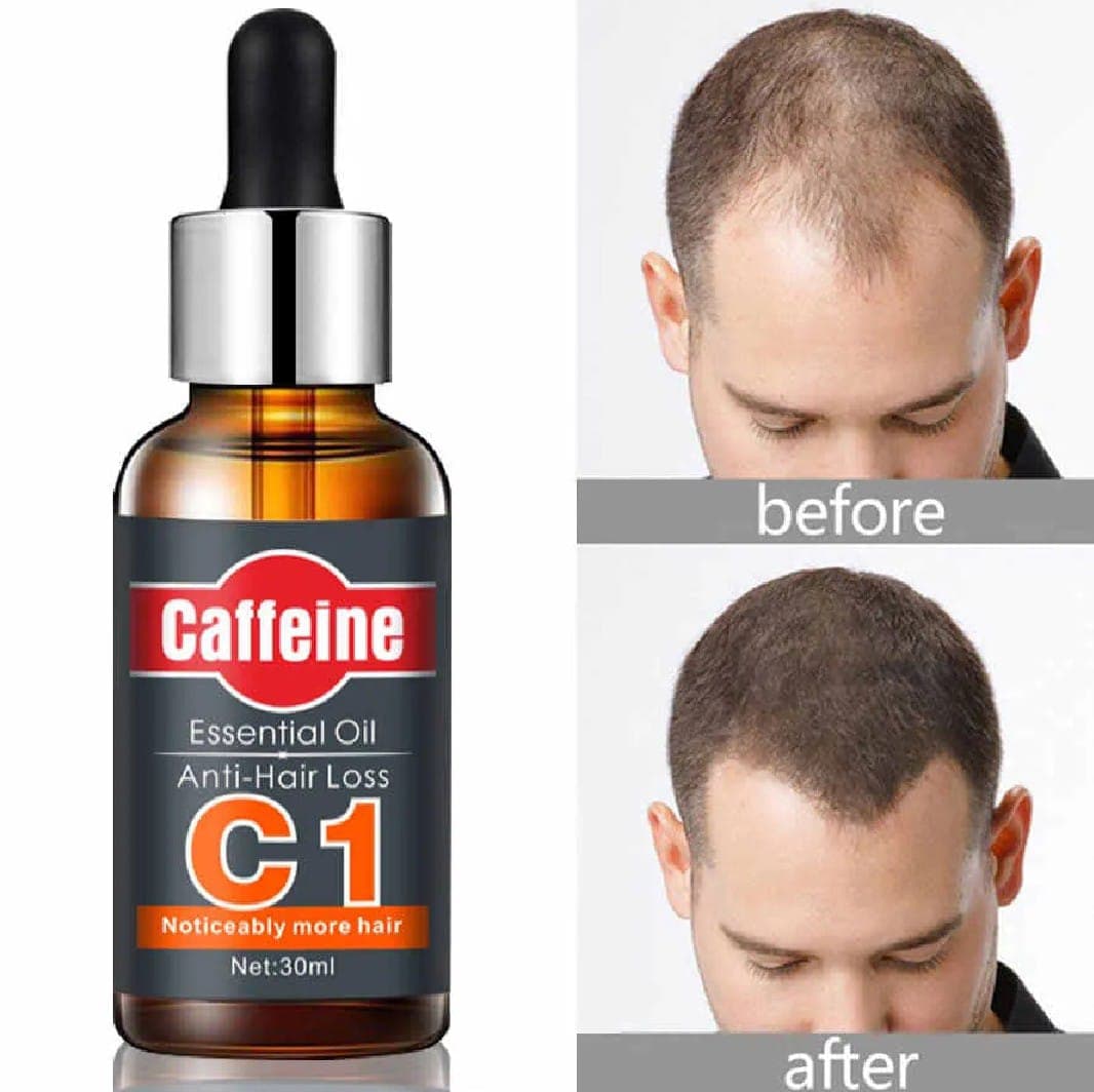 Pei Mei Anti Hair Loss Caffeine Essential Oil - 30ml 5