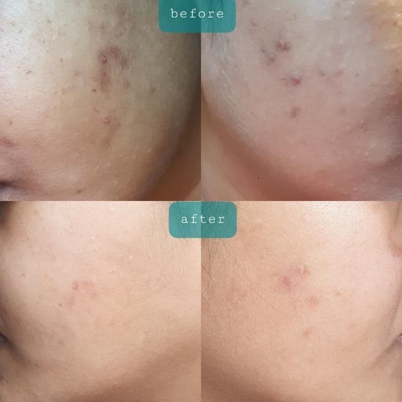 COLLAGEN Facial Serum With Hyaluronic Acid and Multivitamins - 30ml 4