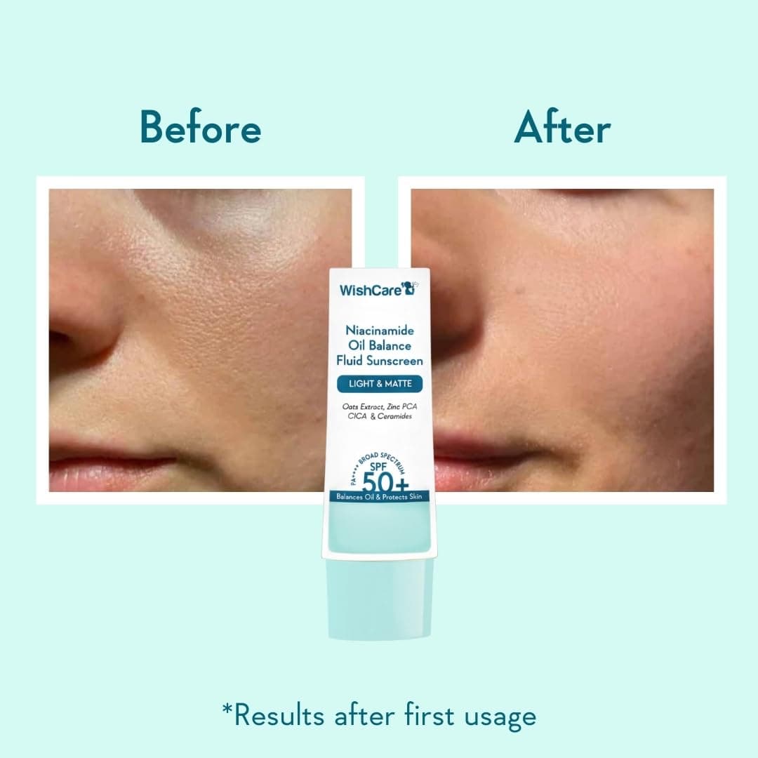 WishCare 5% Niacinamide Oil Balance Fluid Sunscreen SPF 50 PA++++ - Light & Matte Sunscreen for Oily Skin with Broad Spectrum Protection & No White Cast - 50g 1