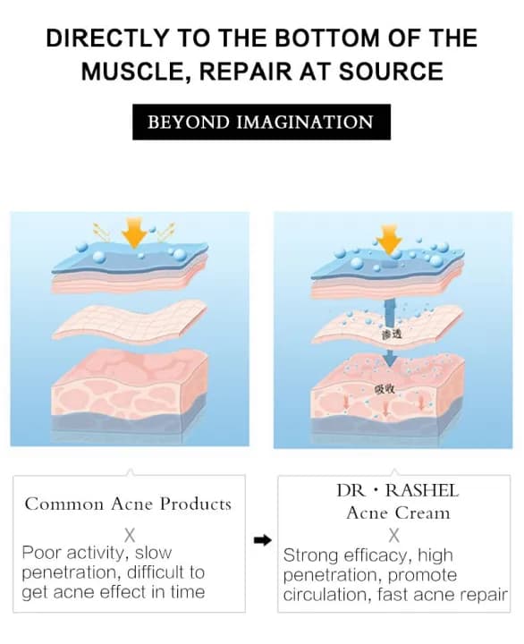 Dr. Rashel Aloe Vera Anti-Acne Pimple Cream Repair Acne Scars 7