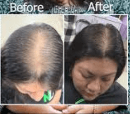 Yachu hair oil 2