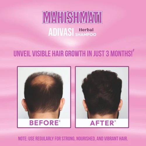 Mahishmati Original Adivasi Herbal Hair Care Kit 200ml (Hair Oil + Shampoo) 7% off 7