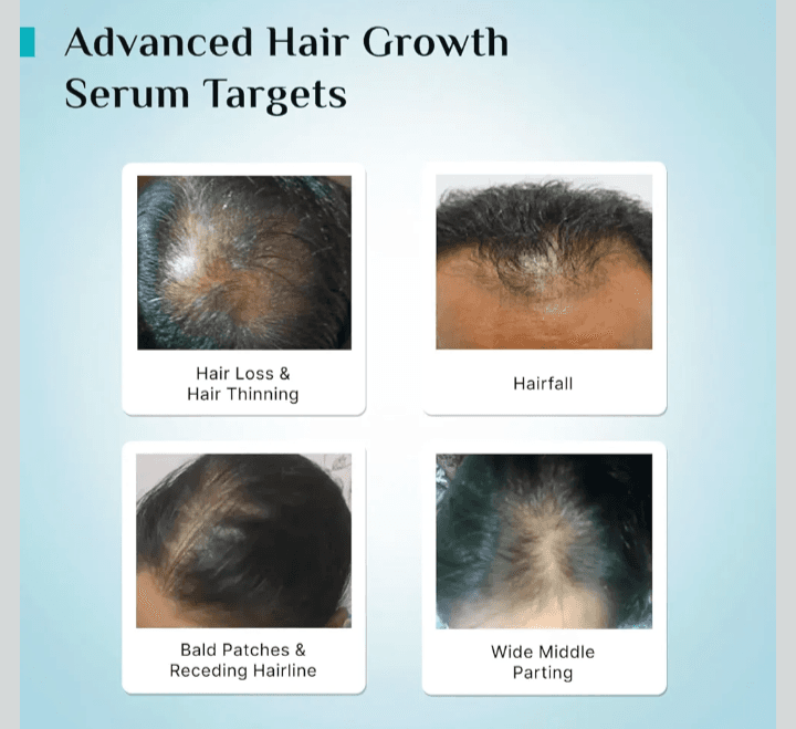 Pilgrim Advanced Hair Growth Serum 30ml 5