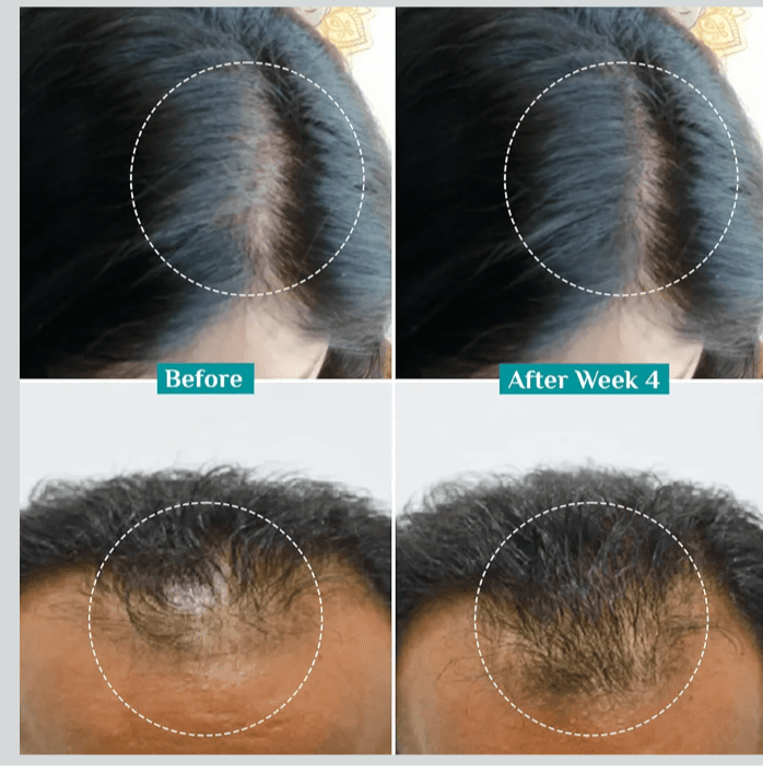 Pilgrim Advanced Hair Growth Serum 30ml 4