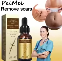 Scar Removal Cream - TCM Scar Serum for Surgical Scars, Acne Skin Care Cream, Acne Treatment Cream for Scars, Burns, Stretch Marks, Acne Spots 30Gm 1