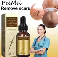 Scar Removal Cream - TCM Scar Serum for Surgical Scars, Acne Skin Care Cream, Acne Treatment Cream for Scars, Burns, Stretch Marks, Acne Spots 30Gm