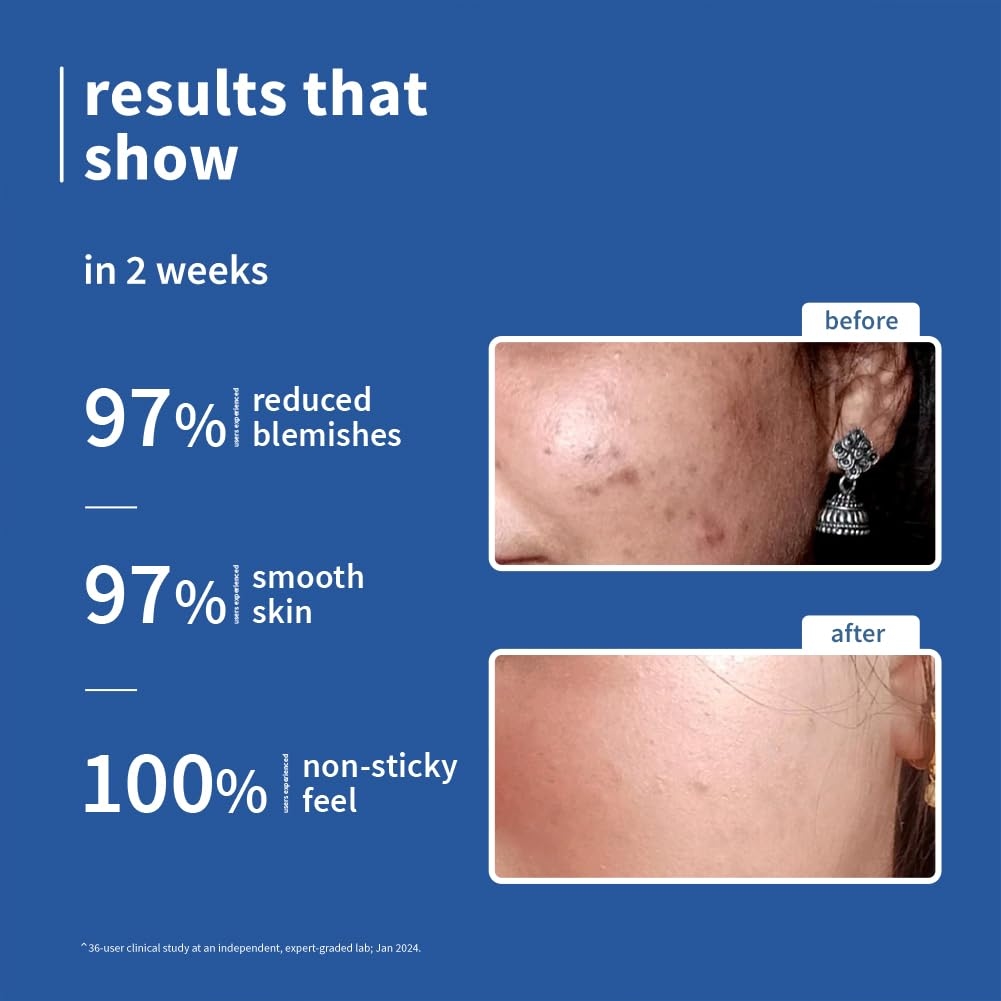 Plum 10% Niacinamide Serum with Rice Water 4