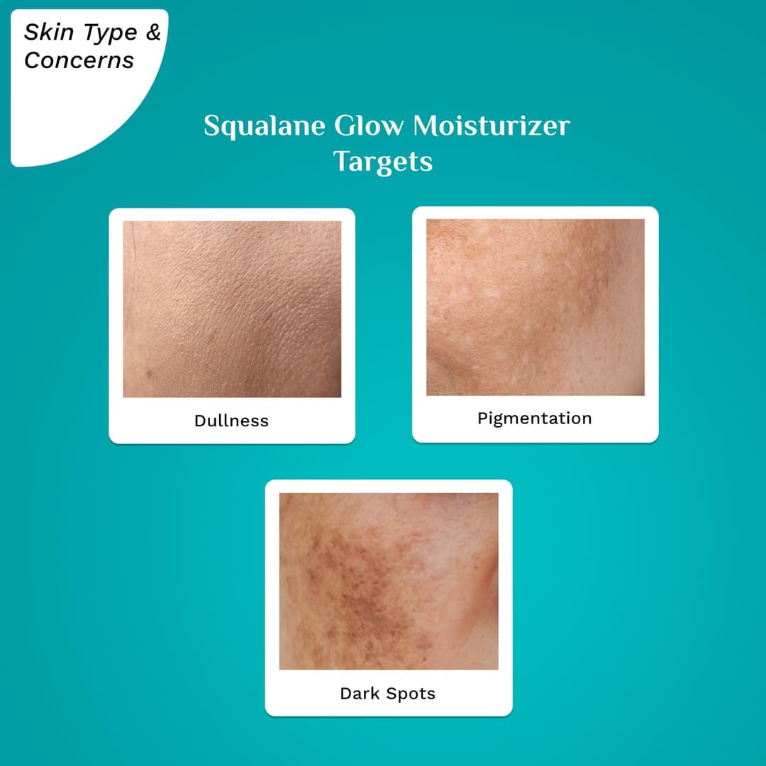 Pilgrim Squalane Niacinamide & Vitamin C Glow Moisturizer Cream for face | Moisturizer for dry skin hydration | Face moisturizer with vitamin c for glowing skin |Non-greasy | For Women and Men I 50 gm 2