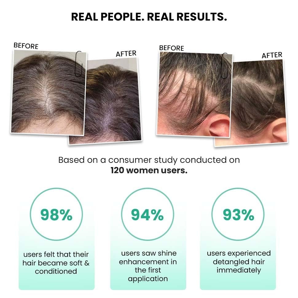 ThriveCo Rosemary Water Hair Spray | With 100% Natural Rosemary Extract, Rice Water & Hyaluronic Acid | For Hair Growth, Hair Fall Control, Hair Conditioning & Hair Shine | Men & Women, 5