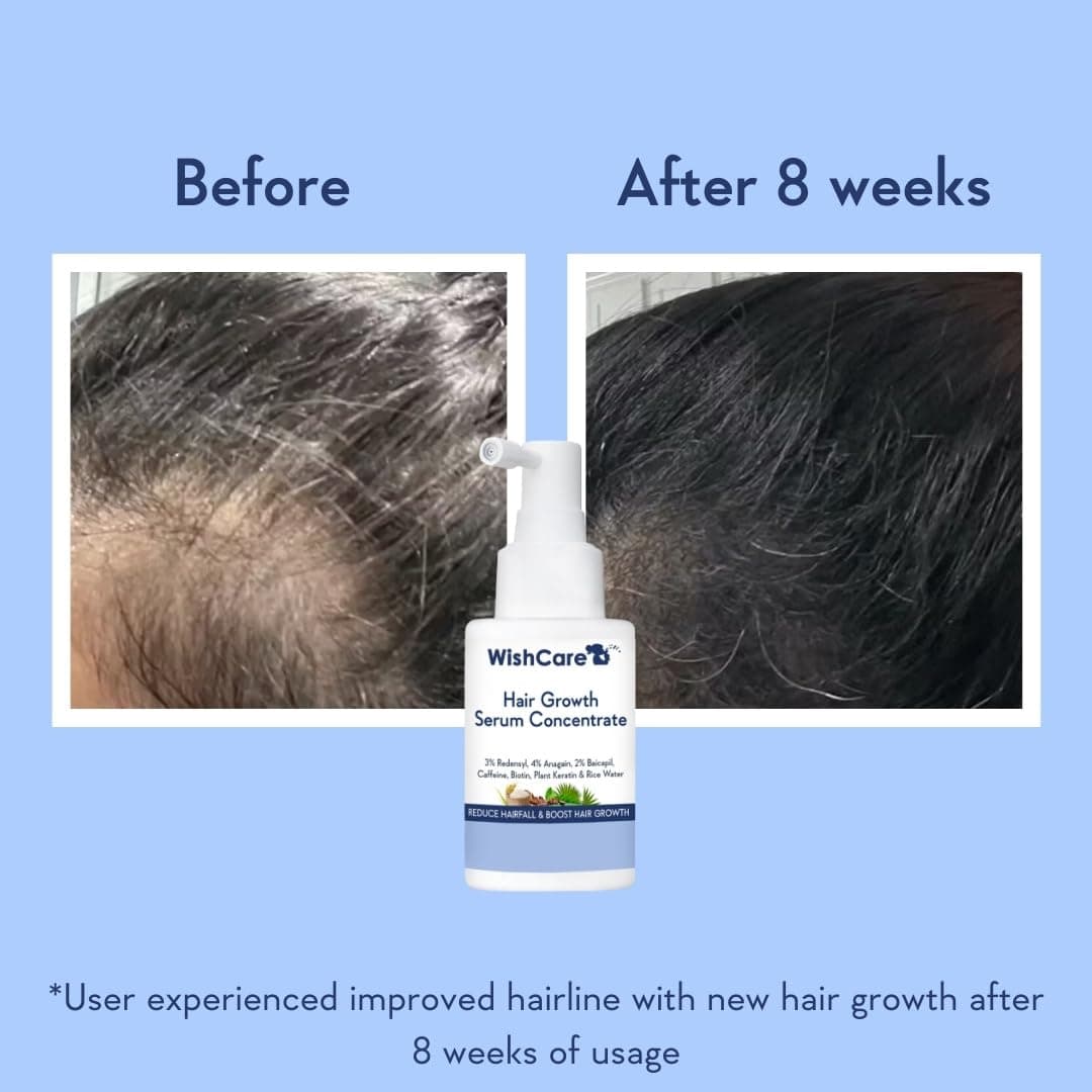 WishCare Hair Growth Serum 3
