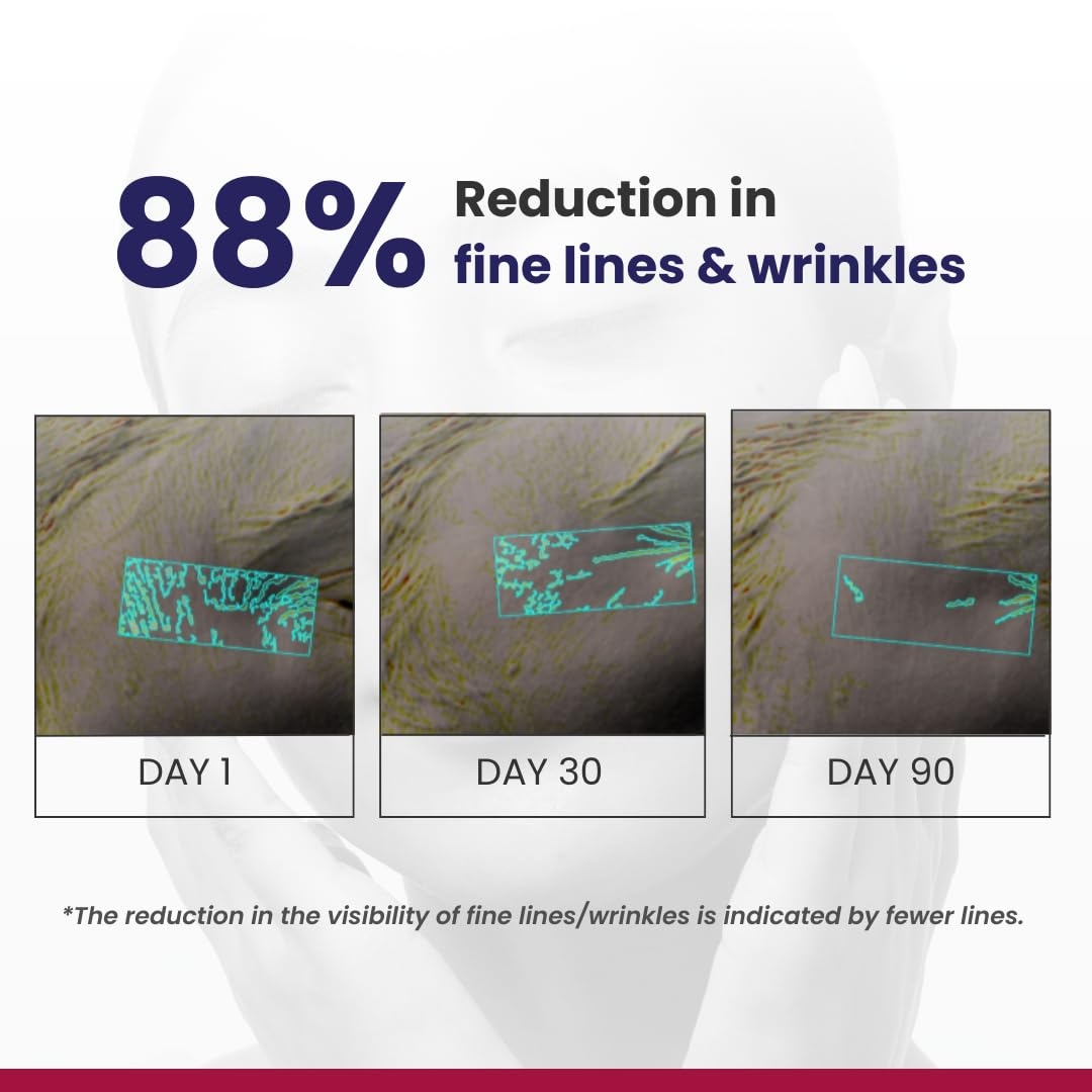 REEQUIL 0.1% Retinol Night Cream | Repairs Wrinkles & Fine Lines | Improves Skin Firmness | Beginner Friendly 5