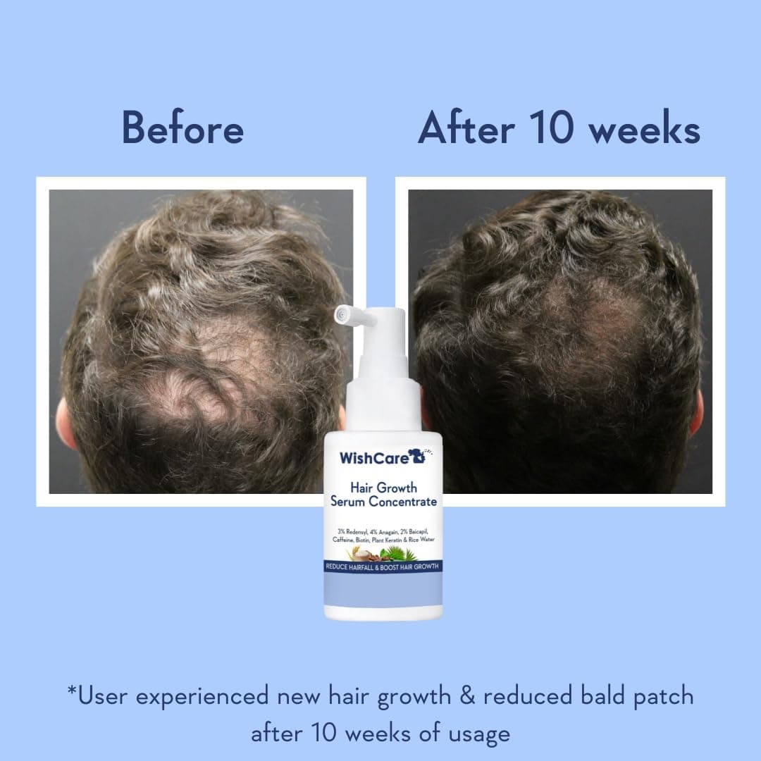 WishCare Hair Growth Serum 2