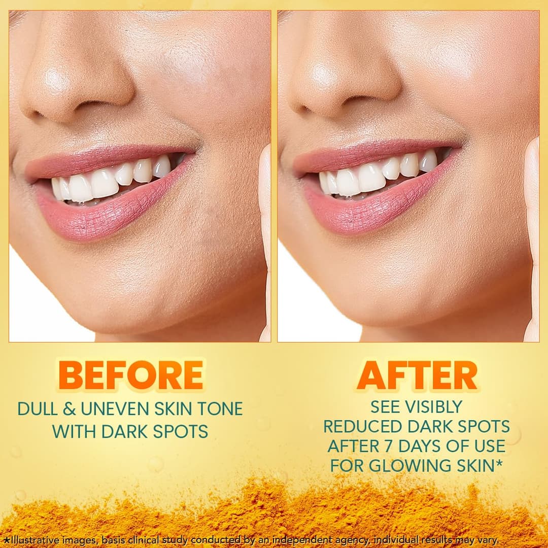 Himalaya Dark Spot Clearing Turmeric Face Serum (30ml) 9