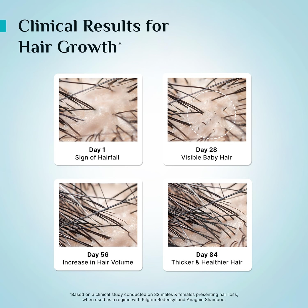 Pilgrim Redensyl 3% + Anagain 4% Advanced Hair Growth Serum (100ml) with Korean Black Rice, Controls Hair Fall, Stimulates Hair Growth, Increase Hair Density | HairGrowth Serum for Men & Women 3
