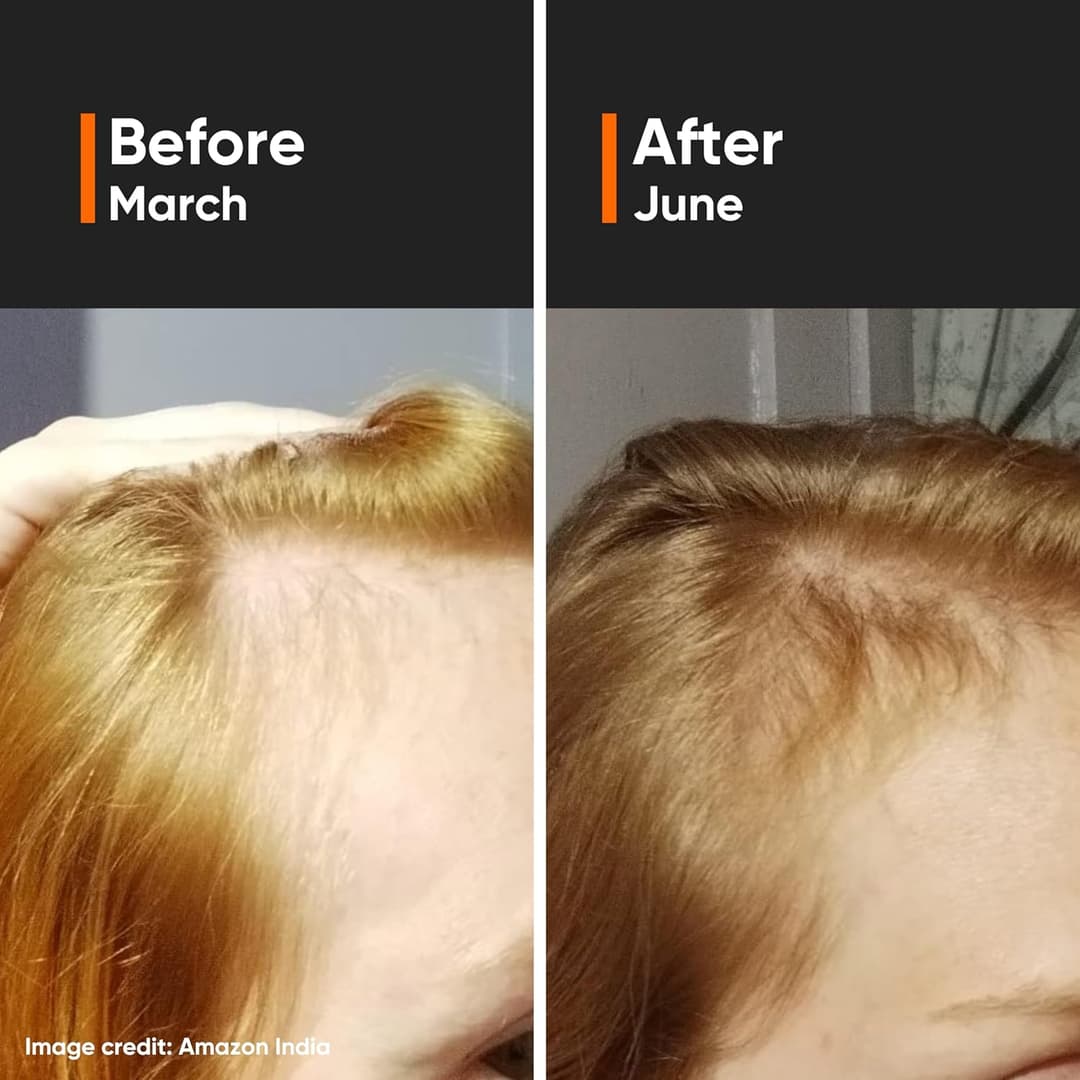 Minimalist Hair Growth serum 1