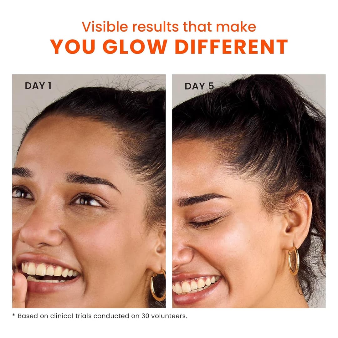 Foxtale Brightening Vitamin C Face Serum with L-Ascorbic Acid And Vitamin E For Glowing Skin (30ml) 5