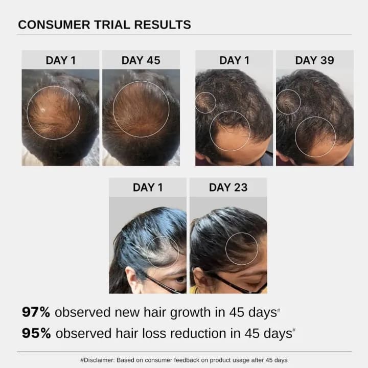 Bare Anatomy Advanced Hair Growth Serum| 3% Redensyl | + 4% Anagain + 3% Baicapil | Rosemary, Biotin | Hair growth & Hair fall control serum for Women & Men | 30mL 3