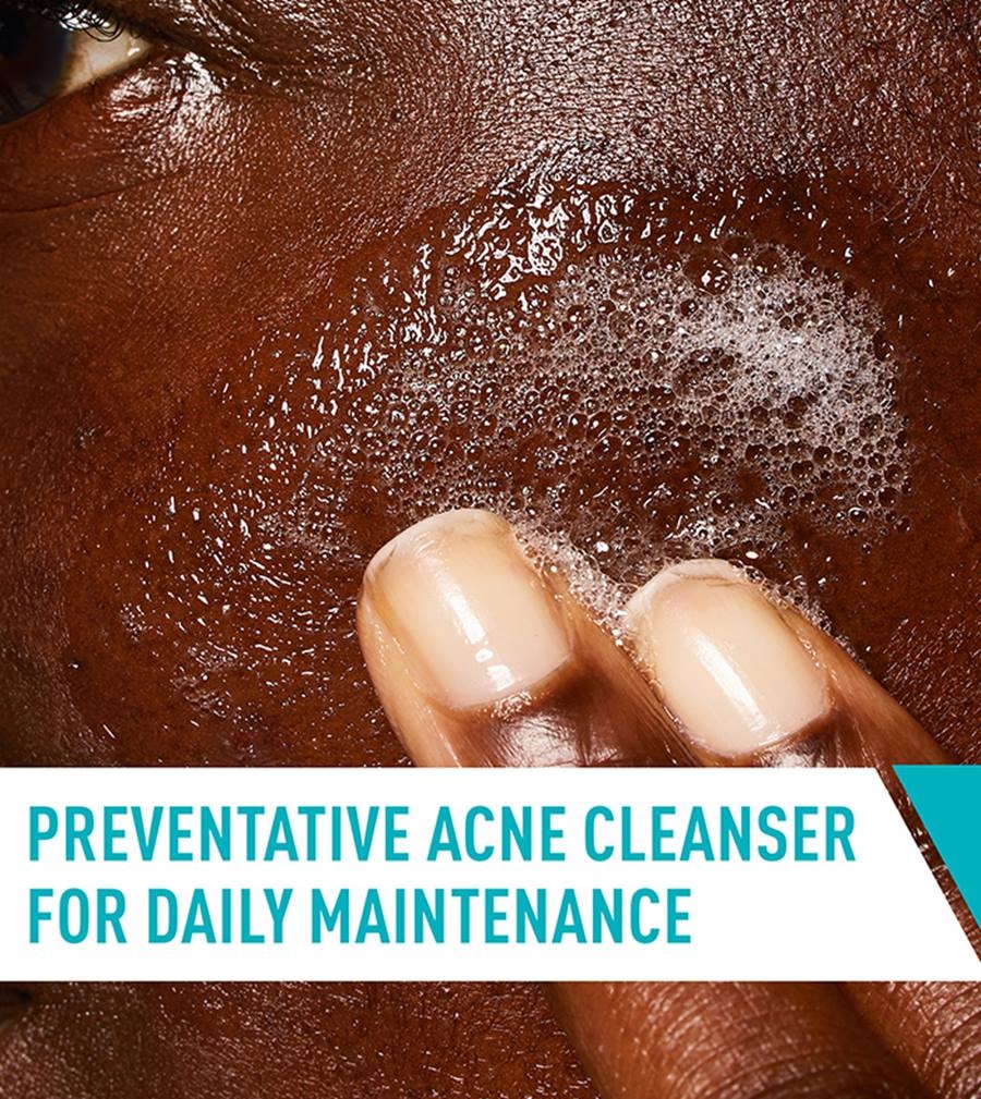 Cerave Acne Control Cleanser (237ml), Salicylic Acid Cleanser 5